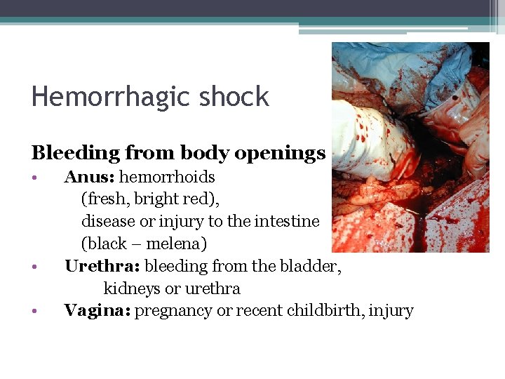 Hemorrhagic shock Bleeding from body openings • • • Anus: hemorrhoids (fresh, bright red),