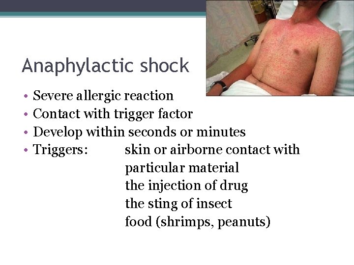 Anaphylactic shock • • Severe allergic reaction Contact with trigger factor Develop within seconds