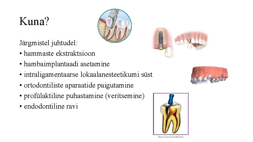 Kuna? Järgmistel juhtudel: • hammaste ekstraktsioon • hambaimplantaadi asetamine • intraligamentaarse lokaalanesteetikumi süst •