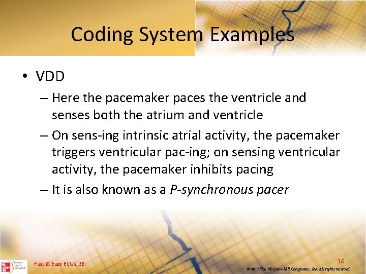 Coding System Examples • VDD – Here the pacemaker paces the ventricle and senses