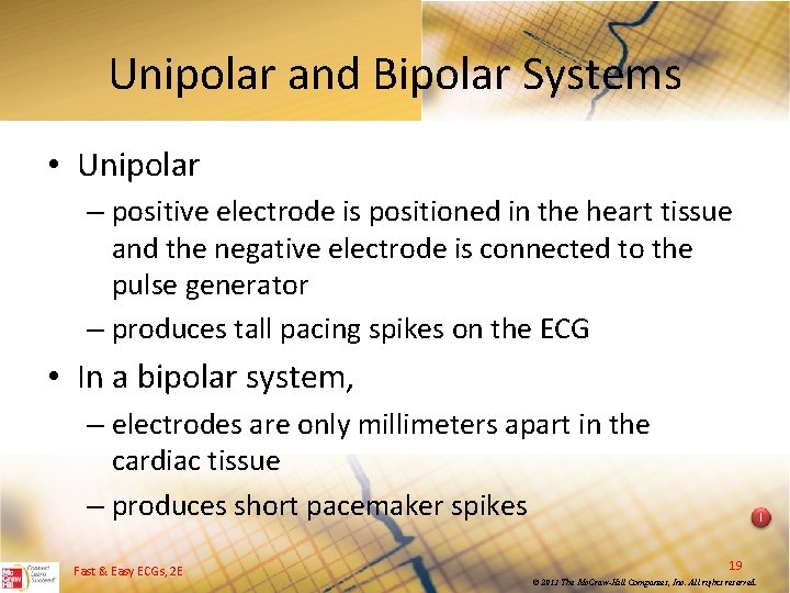 Unipolar and Bipolar Systems • Unipolar – positive electrode is positioned in the heart