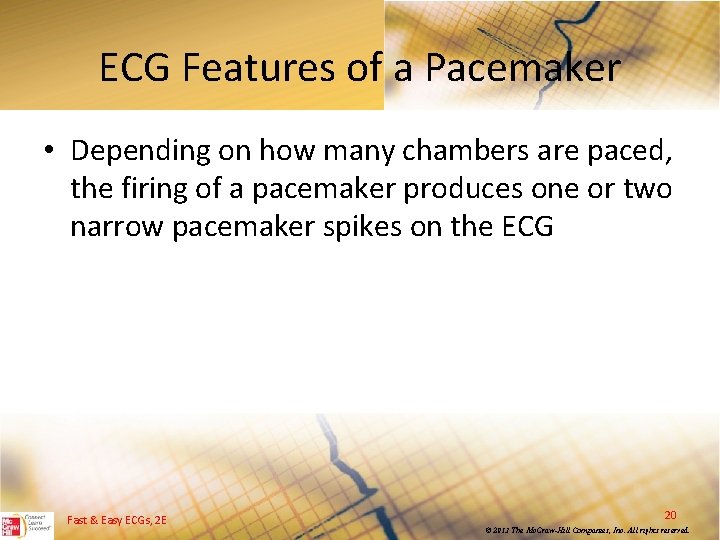 ECG Features of a Pacemaker • Depending on how many chambers are paced, the