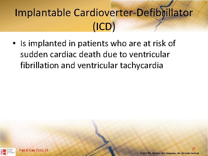 Implantable Cardioverter Defibrillator (ICD) • Is implanted in patients who are at risk of