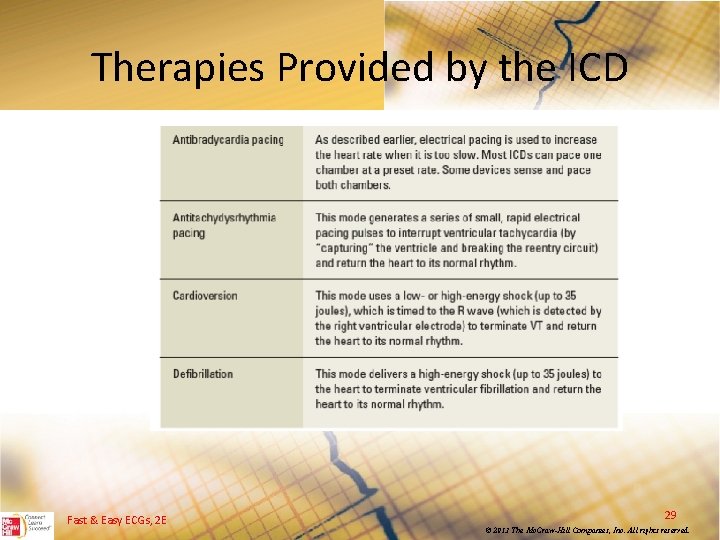 Therapies Provided by the ICD Fast & Easy ECGs, 2 E 29 © 2013