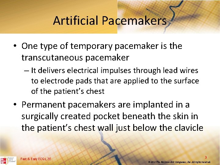 Artificial Pacemakers • One type of temporary pacemaker is the transcutaneous pacemaker – It