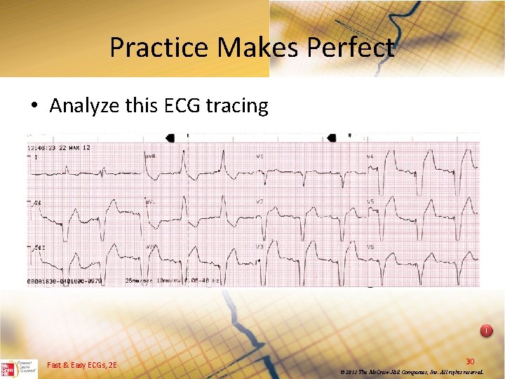 Practice Makes Perfect • Analyze this ECG tracing I Fast & Easy ECGs, 2