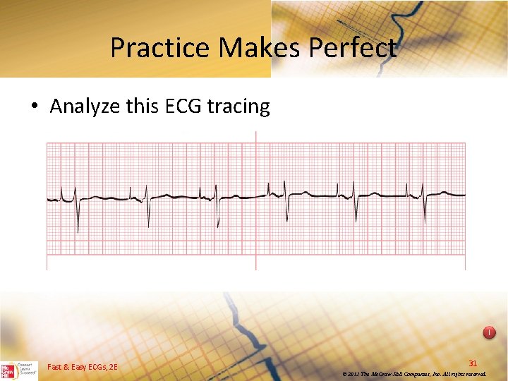 Practice Makes Perfect • Analyze this ECG tracing I Fast & Easy ECGs, 2