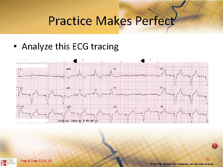 Practice Makes Perfect • Analyze this ECG tracing I Fast & Easy ECGs, 2