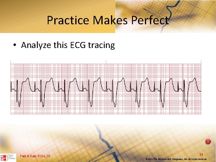 Practice Makes Perfect • Analyze this ECG tracing I Fast & Easy ECGs, 2