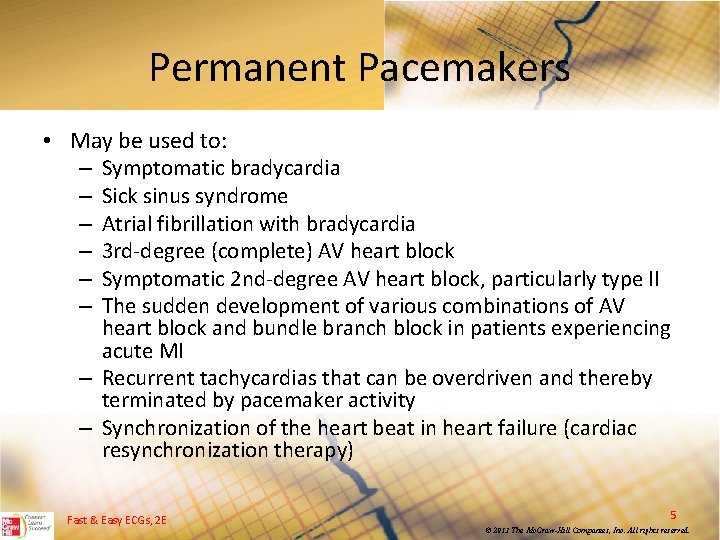 Permanent Pacemakers • May be used to: – Symptomatic bradycardia – Sick sinus syndrome