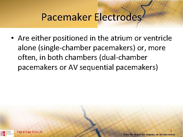 Pacemaker Electrodes • Are either positioned in the atrium or ventricle alone (single chamber