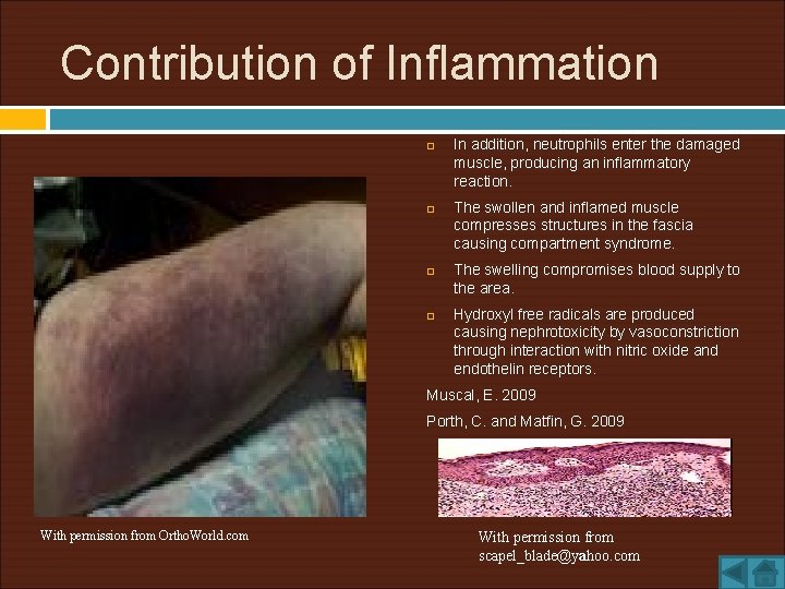 Contribution of Inflammation In addition, neutrophils enter the damaged muscle, producing an inflammatory reaction.