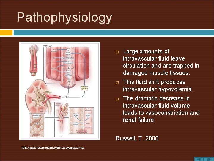 Pathophysiology Large amounts of intravascular fluid leave circulation and are trapped in damaged muscle