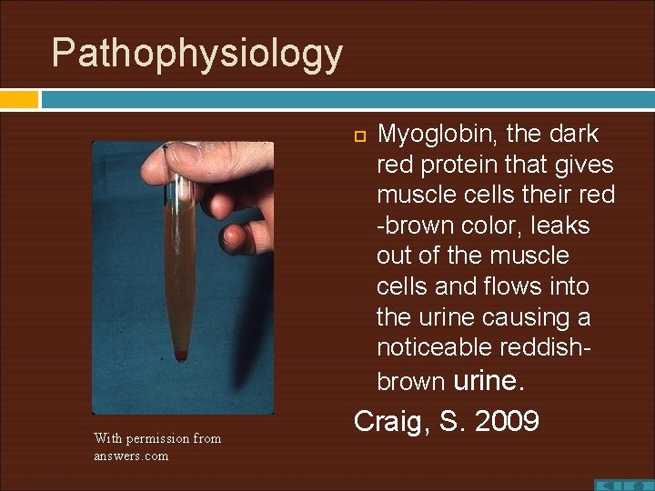 Pathophysiology With permission from answers. com Myoglobin, the dark red protein that gives muscle
