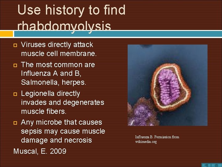 Use history to find rhabdomyolysis Viruses directly attack muscle cell membrane. The most common