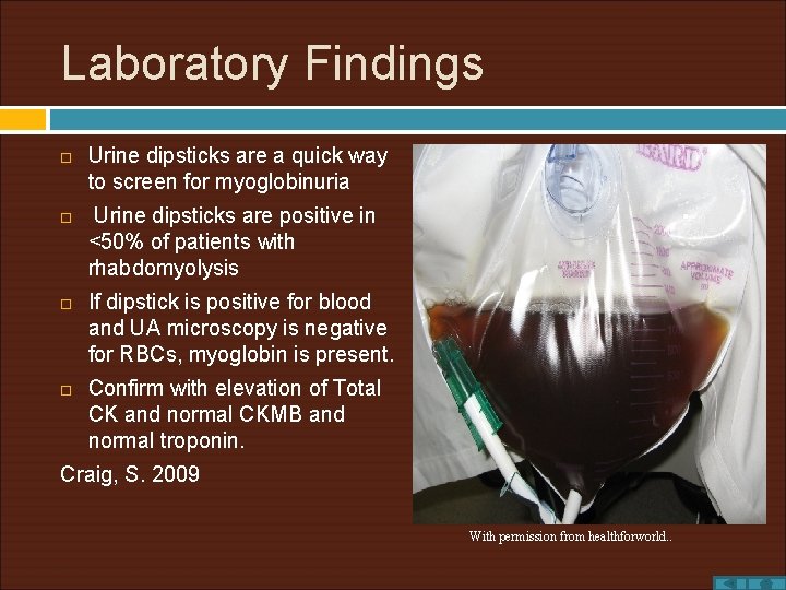 Laboratory Findings Urine dipsticks are a quick way to screen for myoglobinuria Urine dipsticks