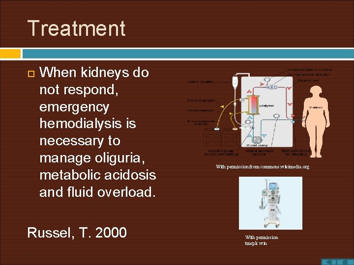 Treatment When kidneys do not respond, emergency hemodialysis is necessary to manage oliguria, metabolic