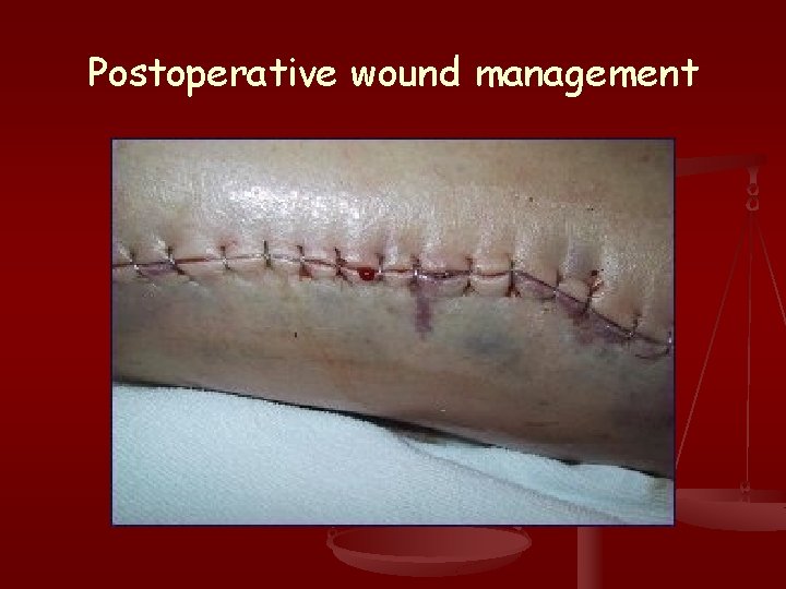 Postoperative wound management 