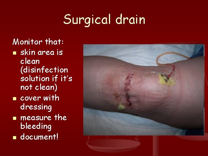 Surgical drain Monitor that: n skin area is clean (disinfection solution if it’s not