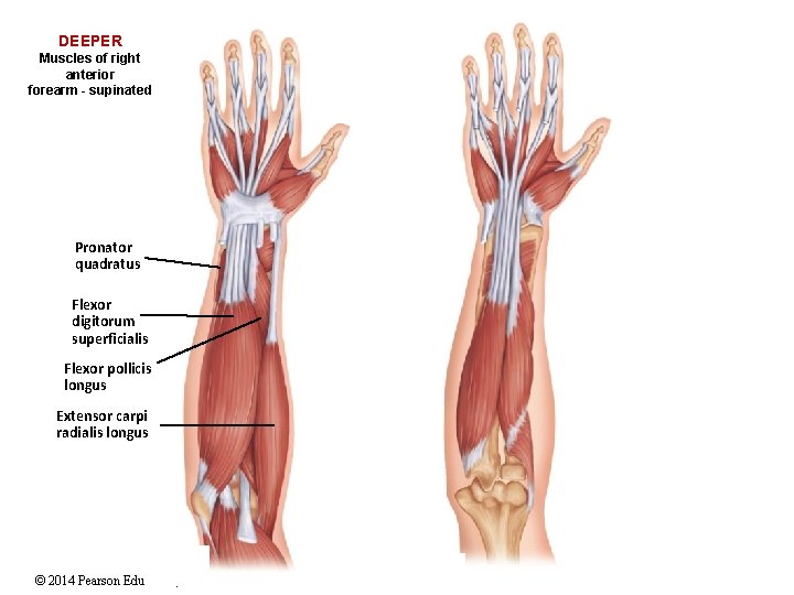 DEEPER Muscles of right anterior forearm - supinated Pronator quadratus Flexor digitorum superficialis Flexor