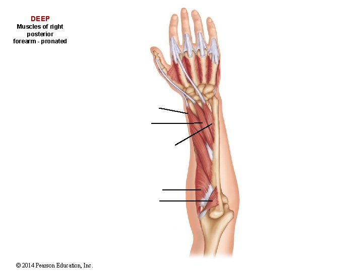 DEEP Muscles of right posterior forearm - pronated © 2014 Pearson Education, Inc. 