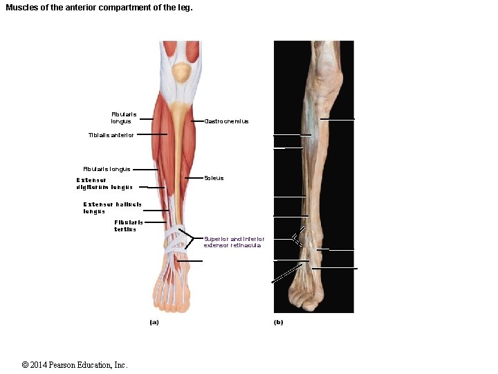 Muscles of the anterior compartment of the leg. Fibularis longus Gastrocnemius Tibialis anterior Fibularis