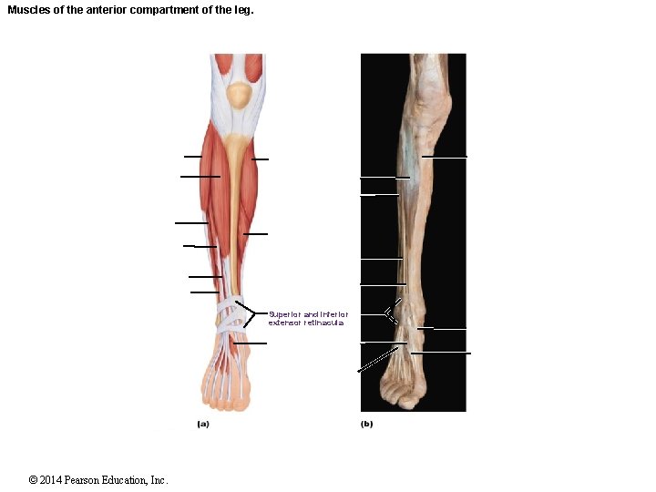 Muscles of the anterior compartment of the leg. Superior and inferior extensor retinacula ©