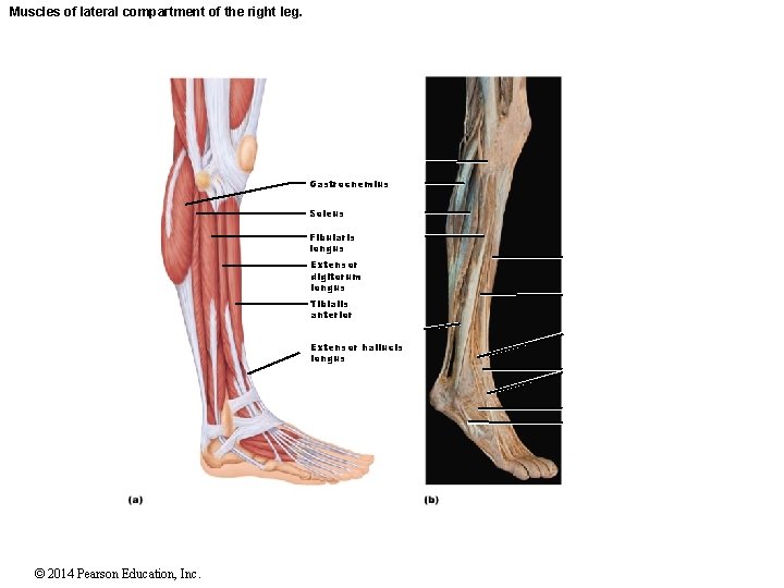 Muscles of lateral compartment of the right leg. Gastrocnemius Soleus Fibularis longus Extensor digitorum