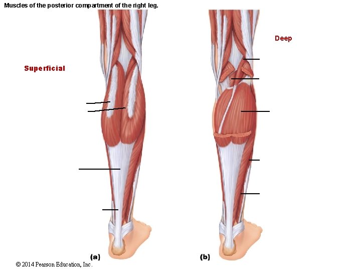 Muscles of the posterior compartment of the right leg. Deep Superficial © 2014 Pearson