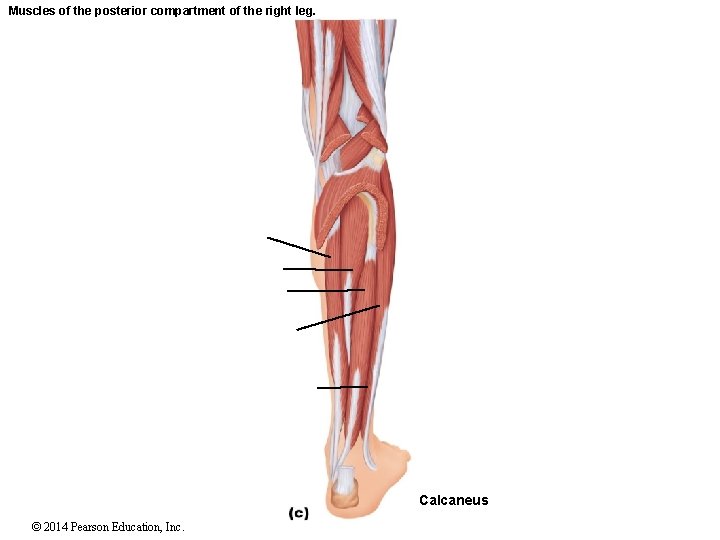 Muscles of the posterior compartment of the right leg. Calcaneus © 2014 Pearson Education,