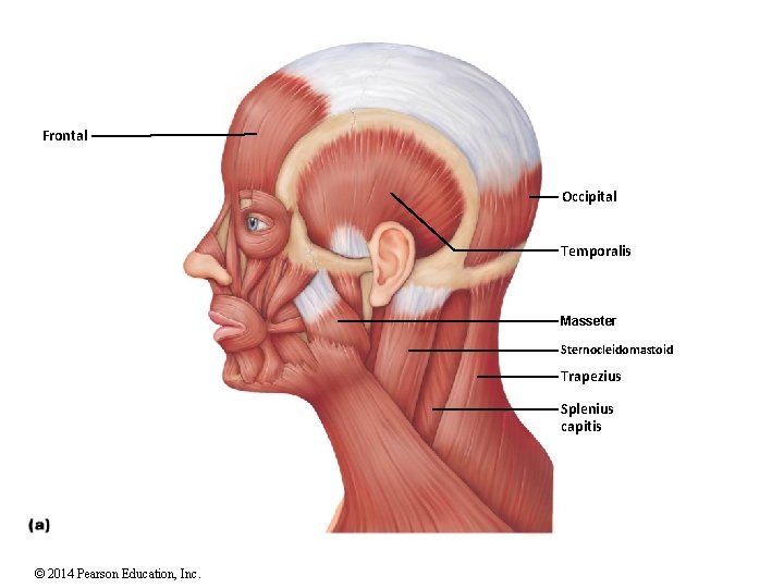 Frontal Occipital Temporalis Masseter Sternocleidomastoid Trapezius Splenius capitis © 2014 Pearson Education, Inc. 