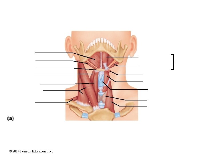 © 2014 Pearson Education, Inc. 