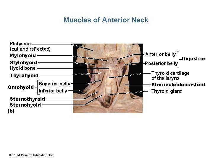 Muscles of Anterior Neck Platysma (cut and reflected) Mylohyoid Stylohyoid Hyoid bone Thyrohyoid Omohyoid
