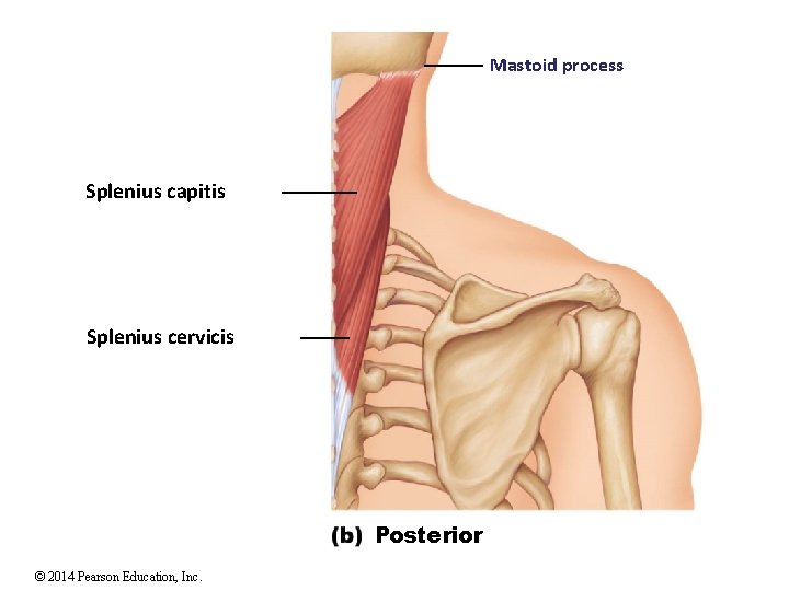 Mastoid process Splenius capitis Splenius cervicis Posterior © 2014 Pearson Education, Inc. 