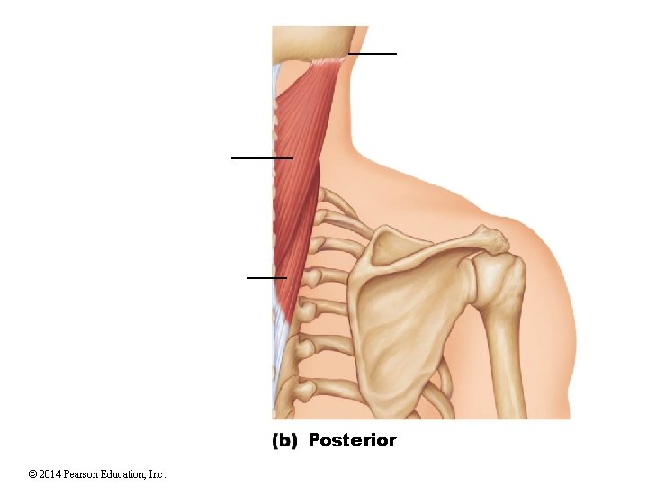 Posterior © 2014 Pearson Education, Inc. 
