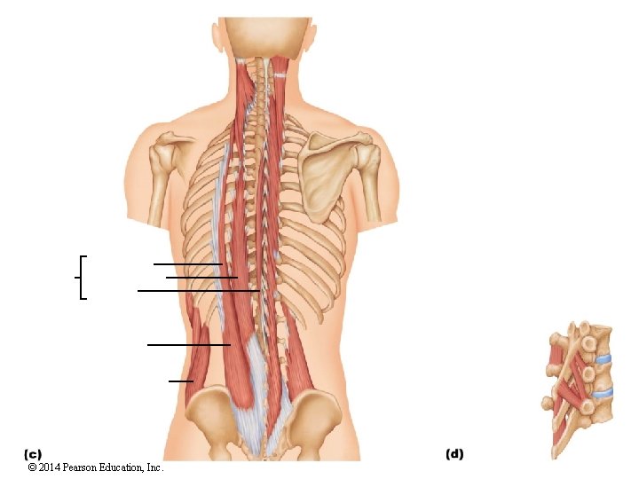 © 2014 Pearson Education, Inc. 