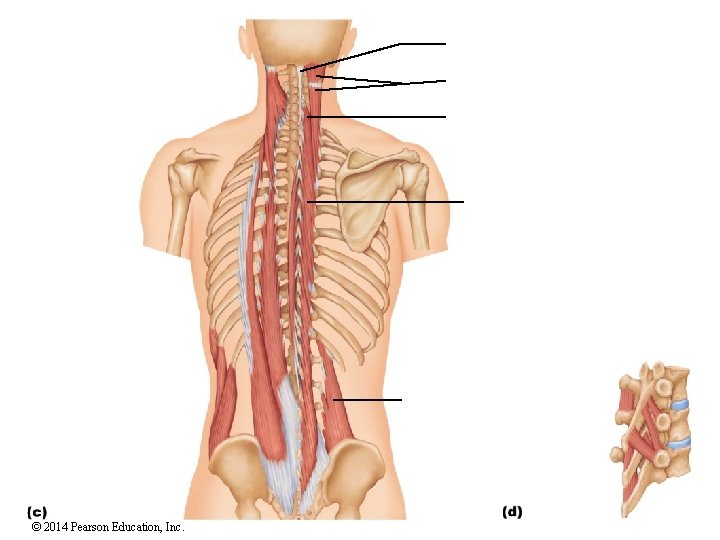 © 2014 Pearson Education, Inc. 