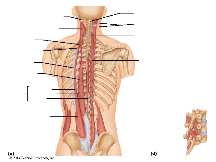 © 2014 Pearson Education, Inc. 