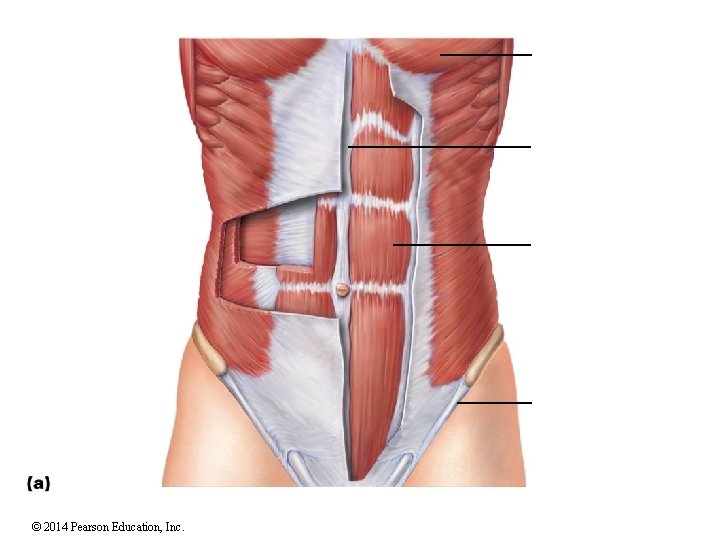 © 2014 Pearson Education, Inc. 