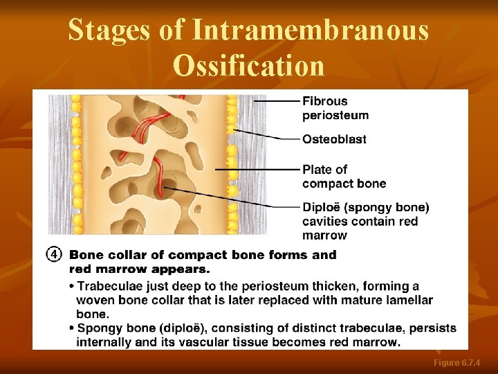 Stages of Intramembranous Ossification Figure 6. 7. 4 