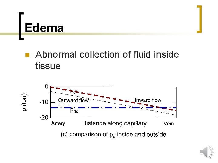 Edema n Abnormal collection of fluid inside tissue 