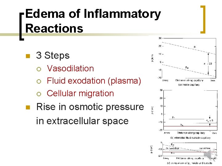 Edema of Inflammatory Reactions n 3 Steps ¡ ¡ ¡ n Vasodilation Fluid exodation