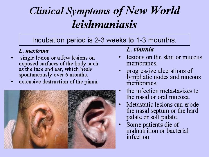 Clinical Symptoms of New World leishmaniasis Incubation period is 2 -3 weeks to 1