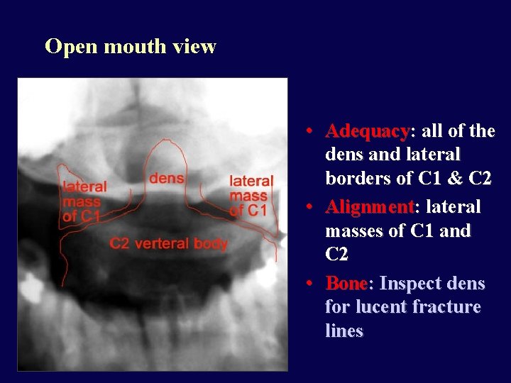 Open mouth view • Adequacy: all of the dens and lateral borders of C