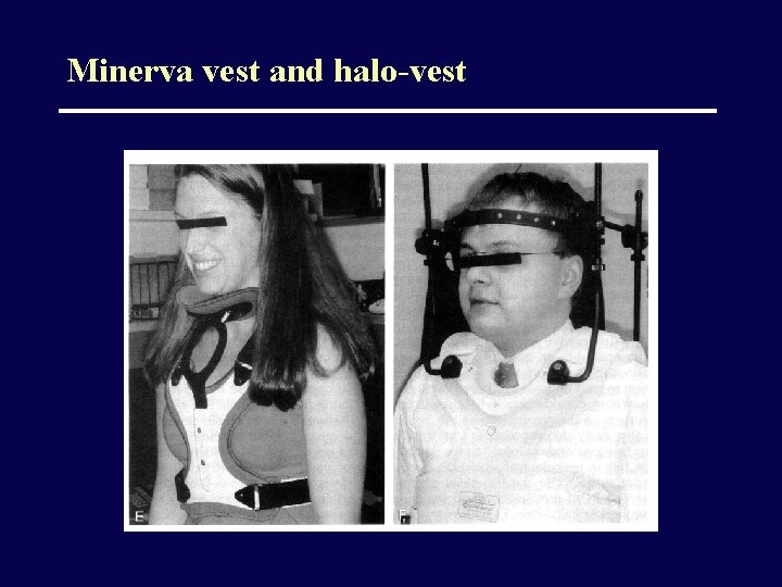 Minerva vest and halo-vest 