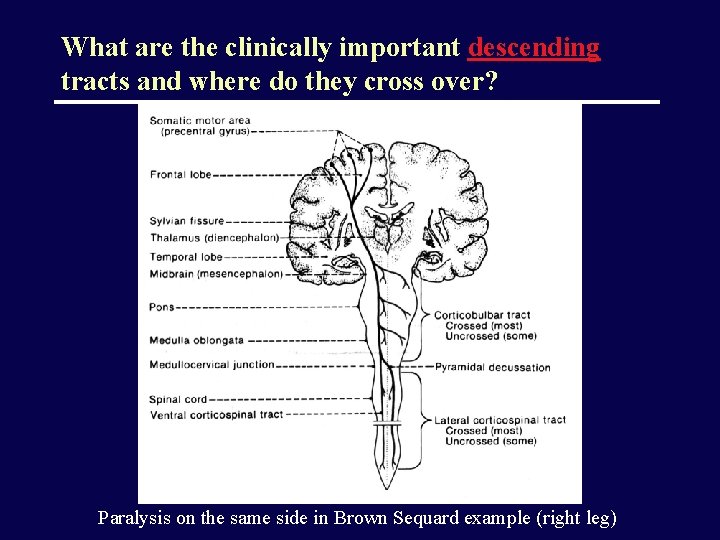 What are the clinically important descending tracts and where do they cross over? Paralysis