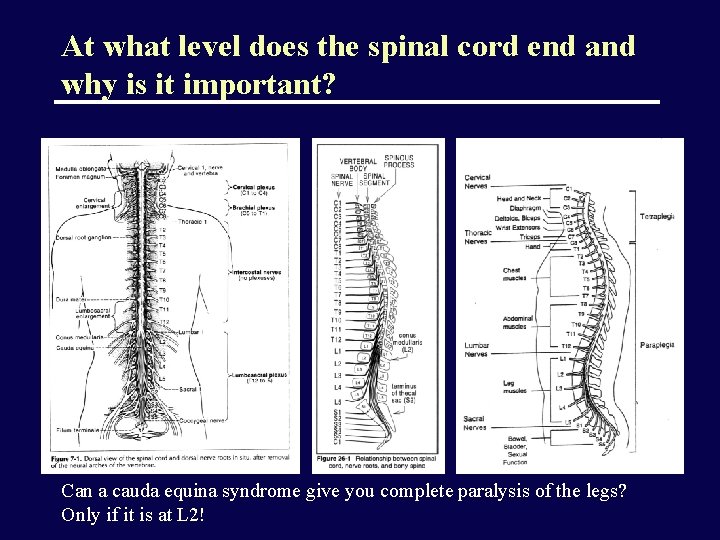 At what level does the spinal cord end and why is it important? Can