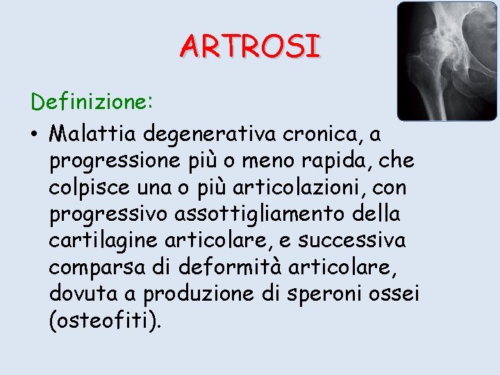 ARTROSI Definizione: • Malattia degenerativa cronica, a progressione più o meno rapida, che colpisce