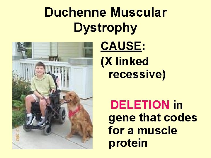 Duchenne Muscular Dystrophy CAUSE: (X linked recessive) DELETION in gene that codes for a