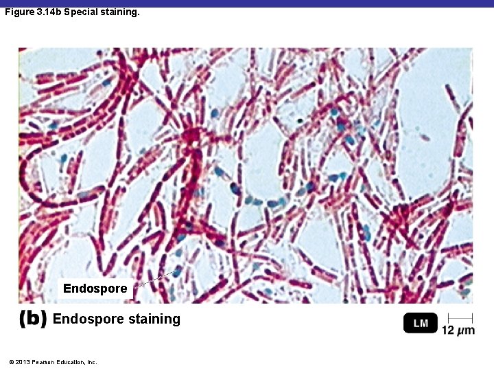 Figure 3. 14 b Special staining. Endospore staining © 2013 Pearson Education, Inc. 